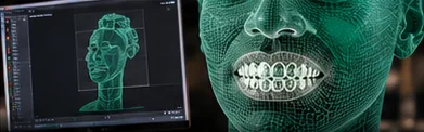 3D scan of a face and teeth for a grillz design
