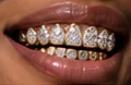 Grillz Gal 1