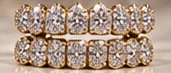 Grillz Type Fullsets